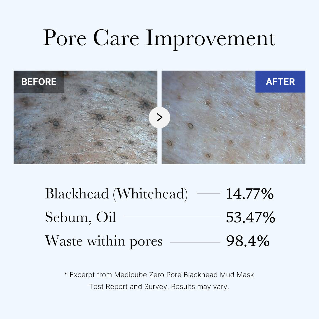 Zero Pore Blackhead Mud Mask, 100g