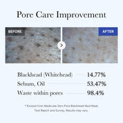Zero Pore Blackhead Mud Mask, 100g