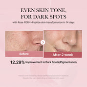 PDRN Pink Peptide Toner, 250ml