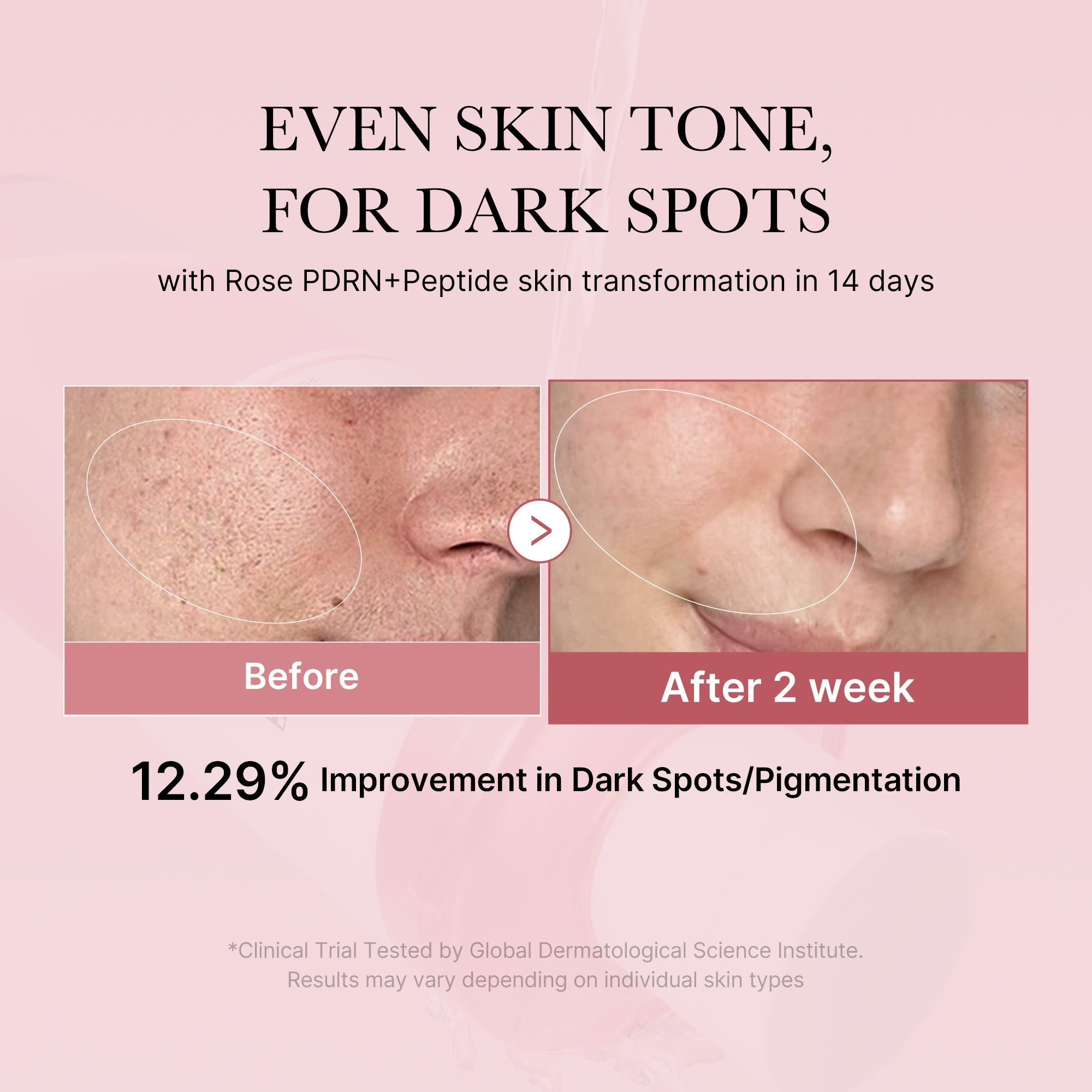 PDRN Pink Peptide Toner, 250ml